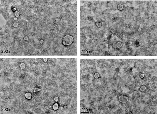 electron-microscopic observation of hela exosomes