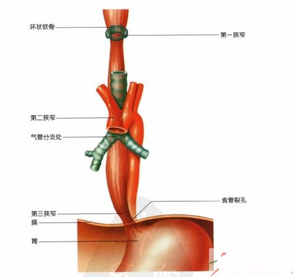 临床指出:食道癌术后并发症除吻合口瘘外,患者还可出现腹泻,反流性食