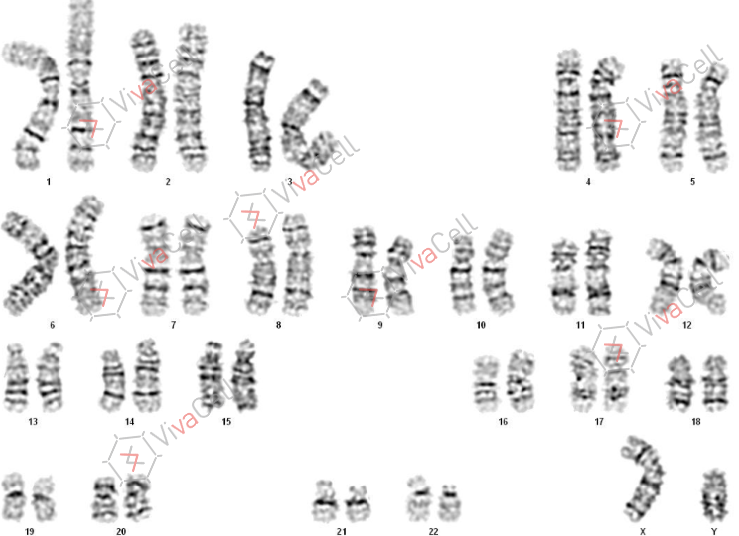 染色體核型分析技術服務 | 幹細胞研究瞭解下